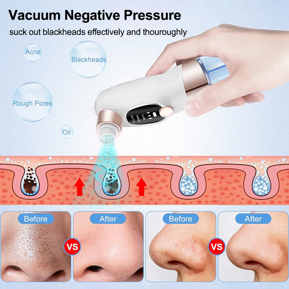 Blackhead Remover Electric Bla - Air Bubble Remover ulasan dan harga